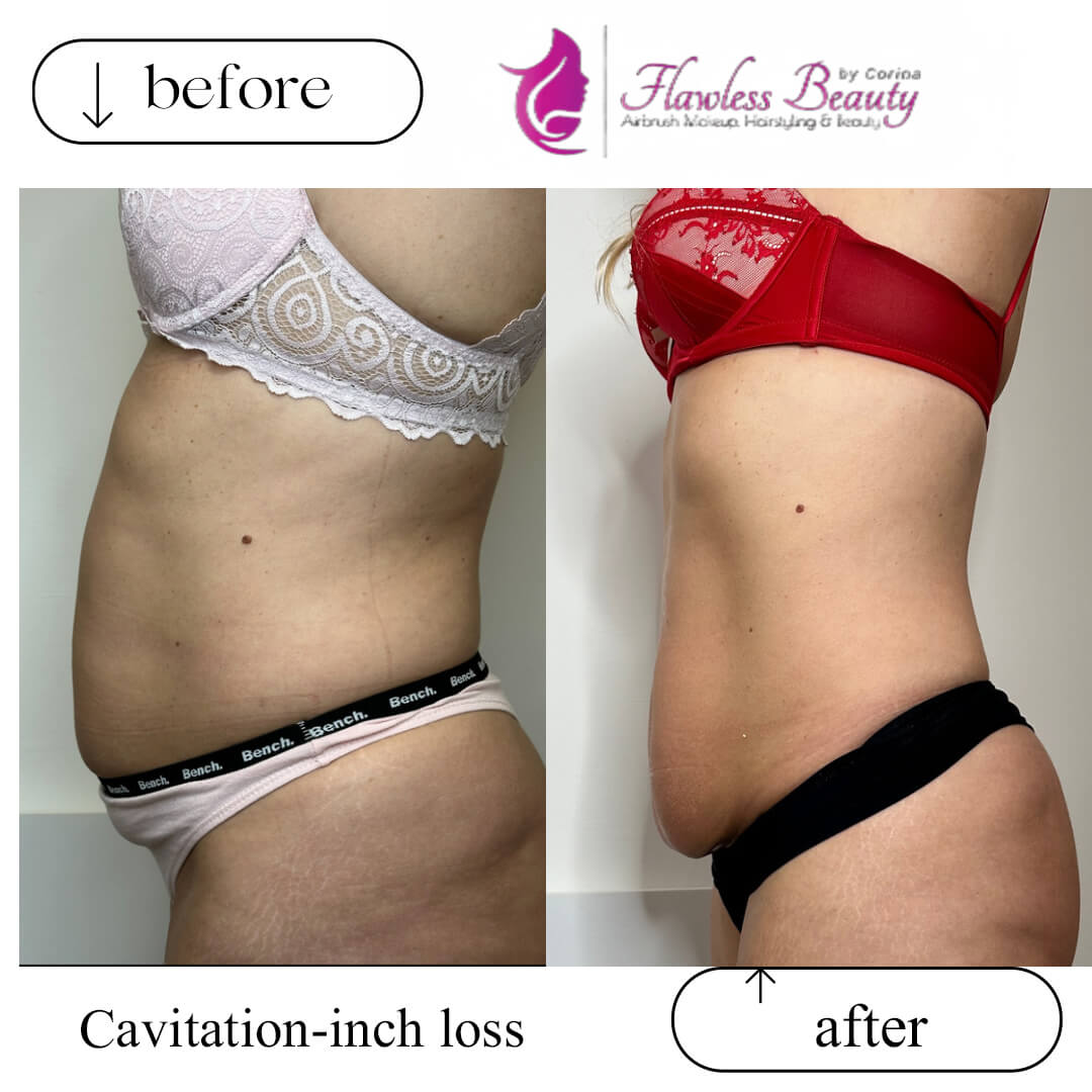 Cavitation-inch loss 2(1)